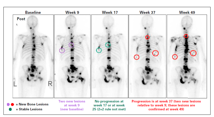 Response Assessment Tool